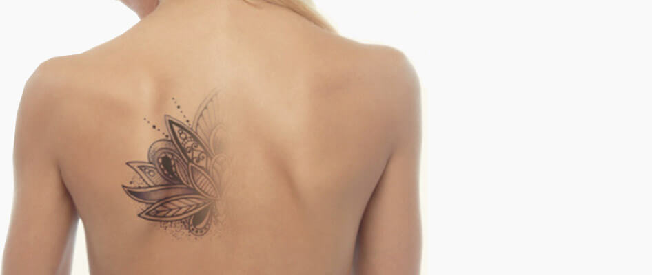 Tattoo Removal Certification